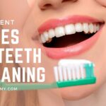 Types of Teeth Cleaning